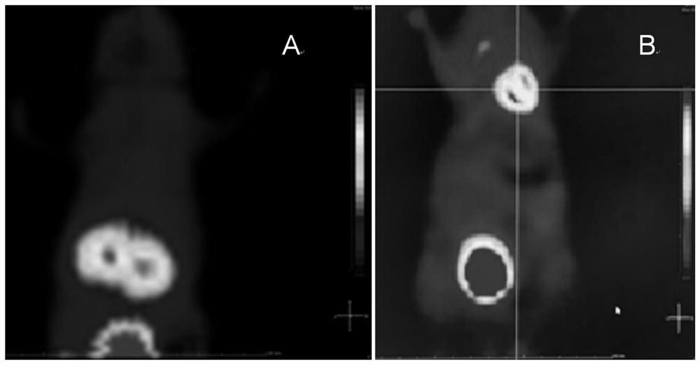 Tumor PET imaging agent &lt;68&gt;Ga-NOTA-ADG and preparation method and application thereof