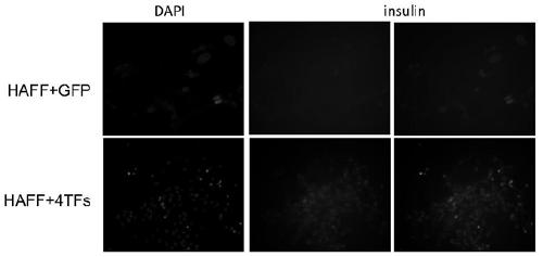 A method for inducing insulin-secreting cells based on human skin cells and its application