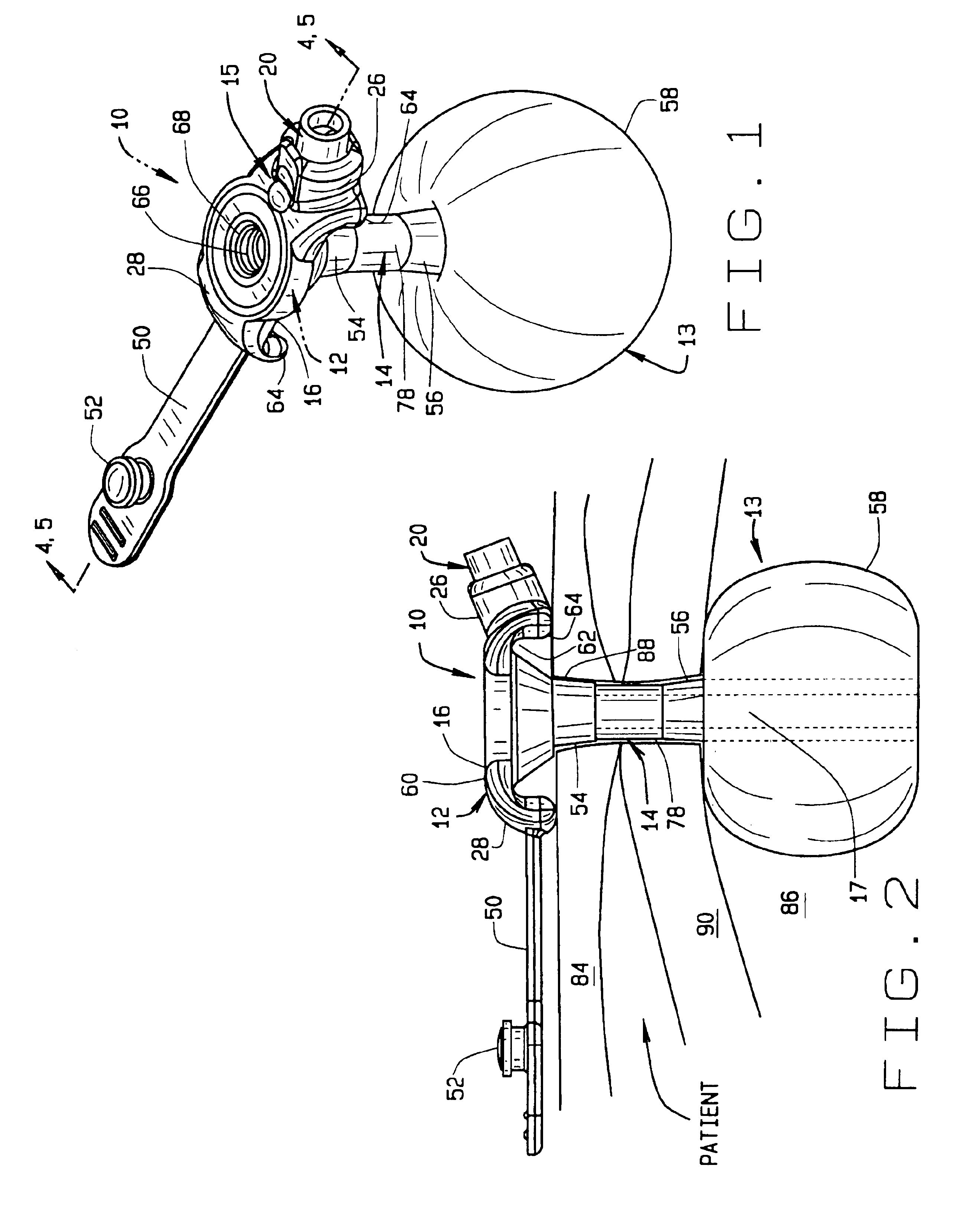 External inflation indicator for a low profile gastrostomy tube