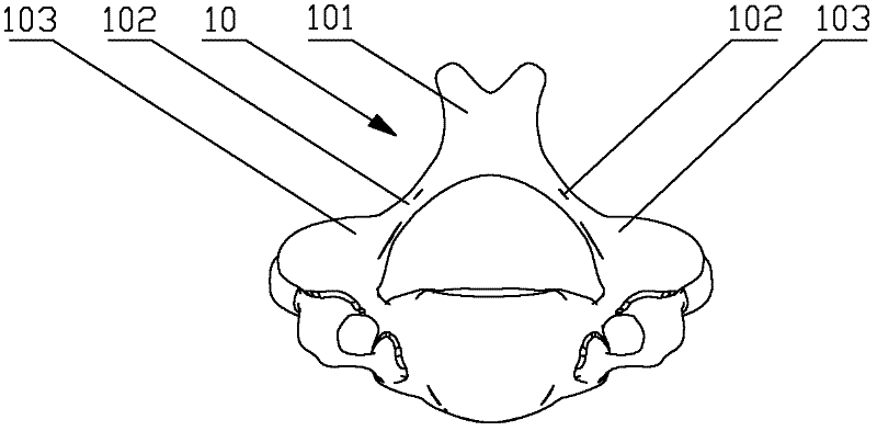 Vertebral plate steel plate for cervical vertebral body