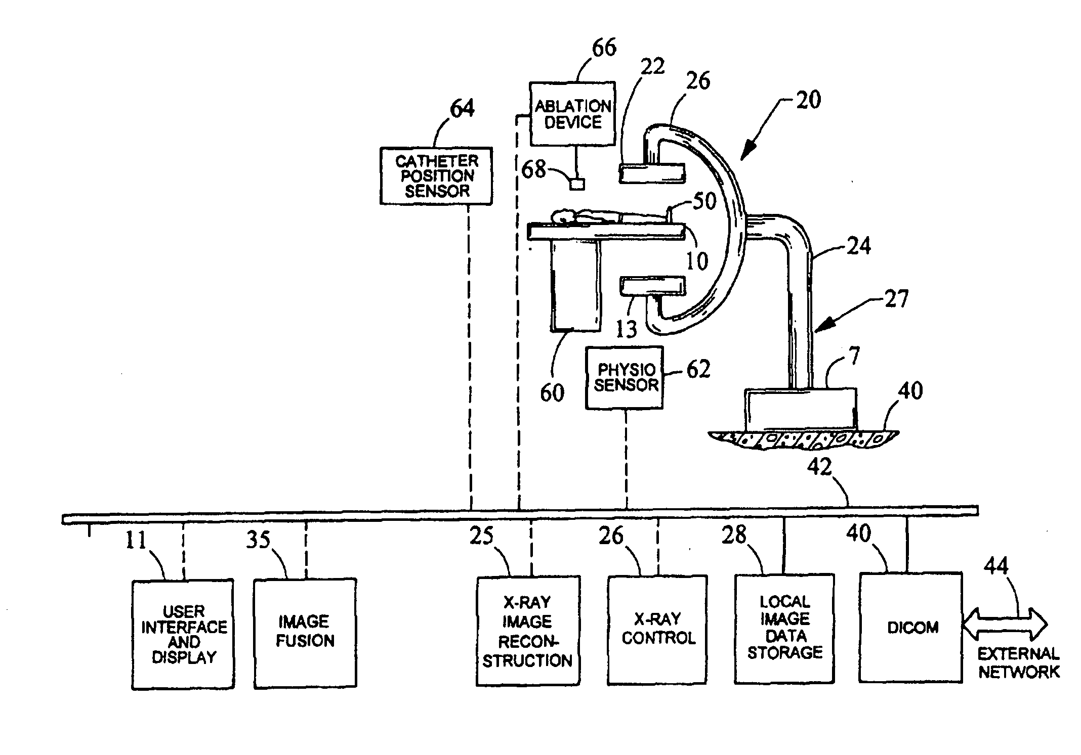 Method and system for performing ablation to treat ventricular tachycardia