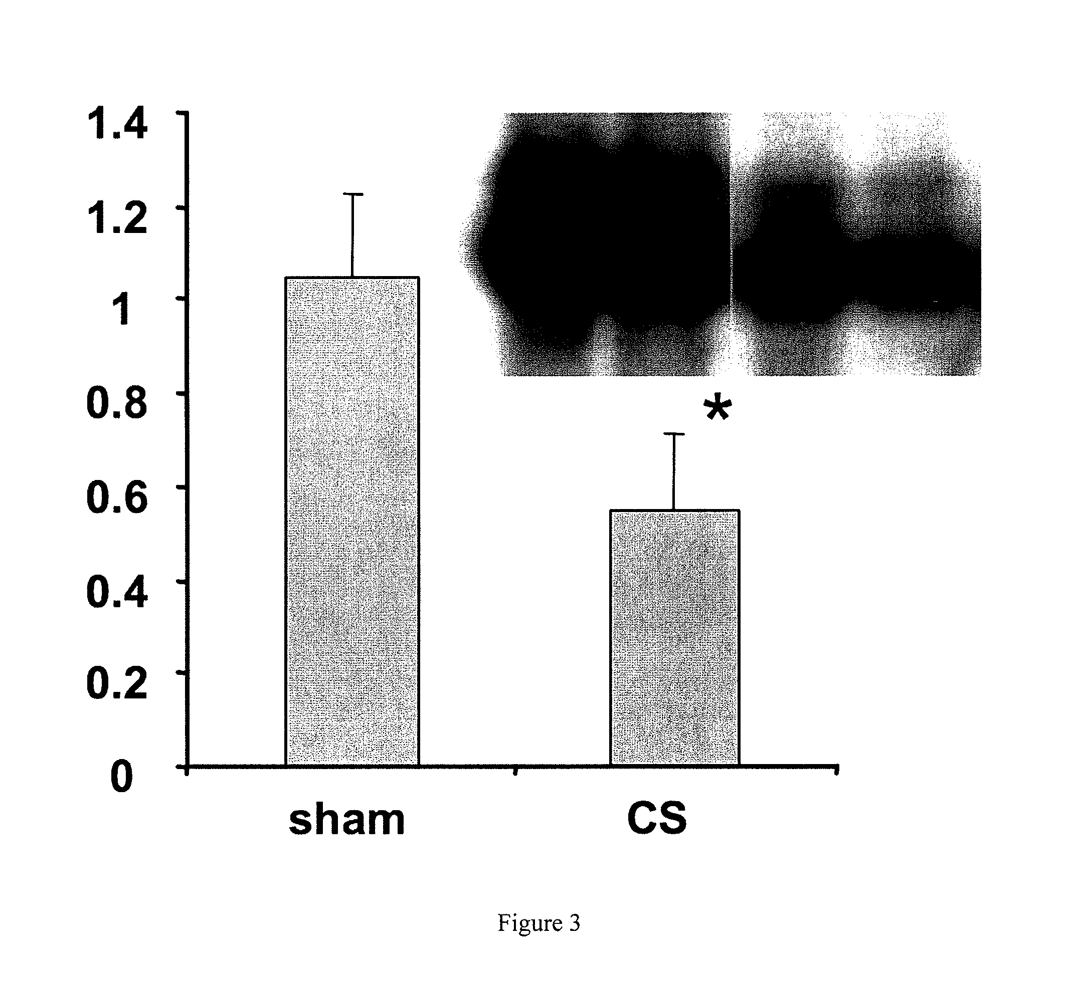 Administration of an adsorbent polymer for treatment of systemic inflammation