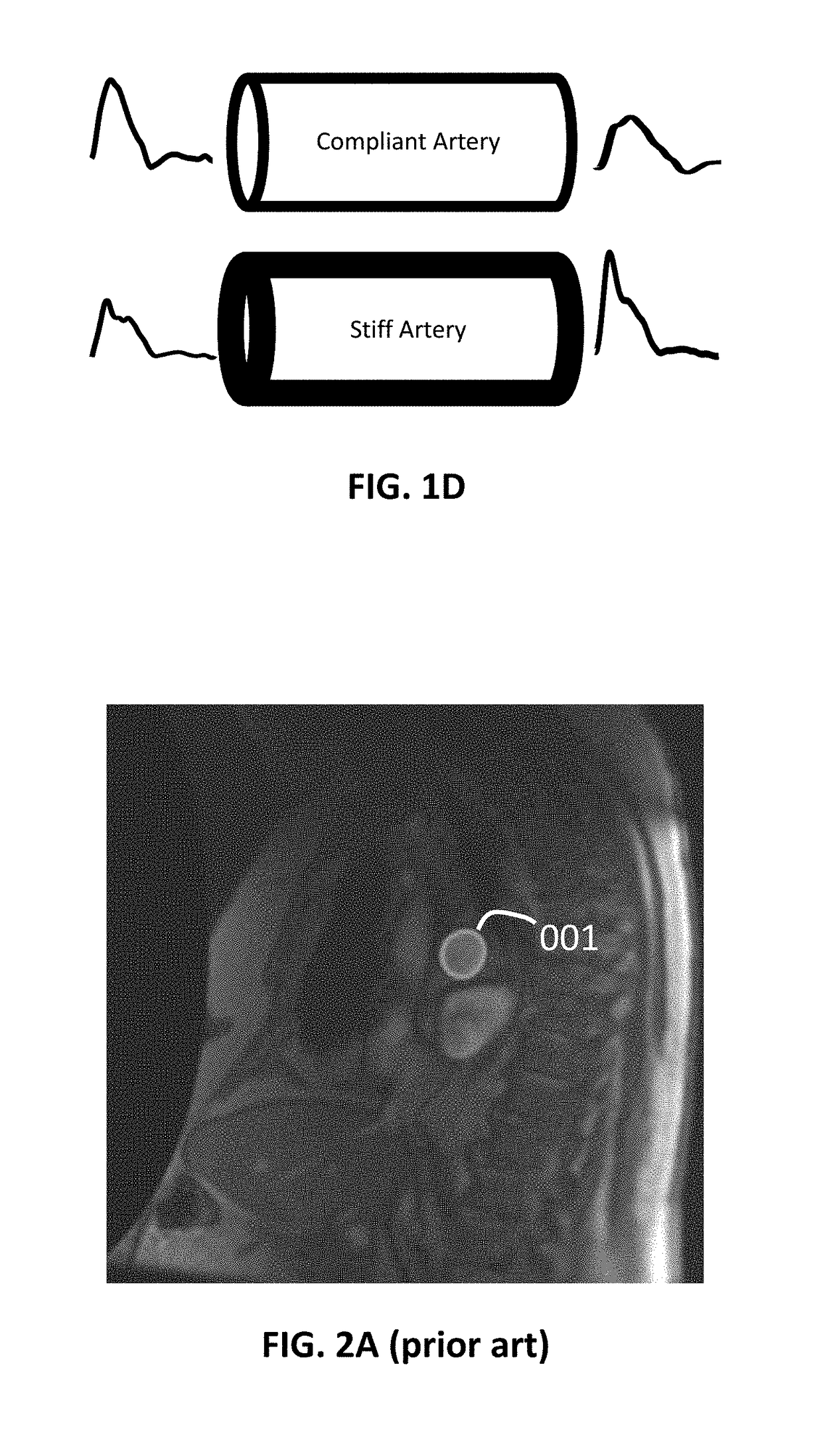 Method and system for evaluating blood vessel