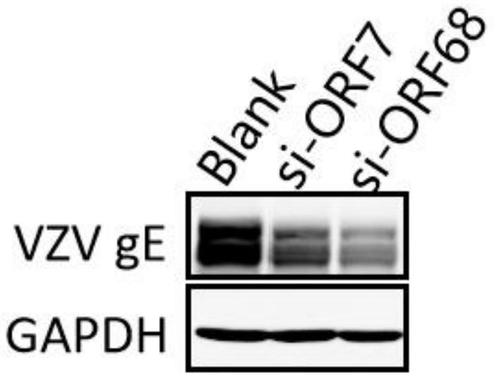 Anti-varicella-zoster virus siRNAs and application thereof