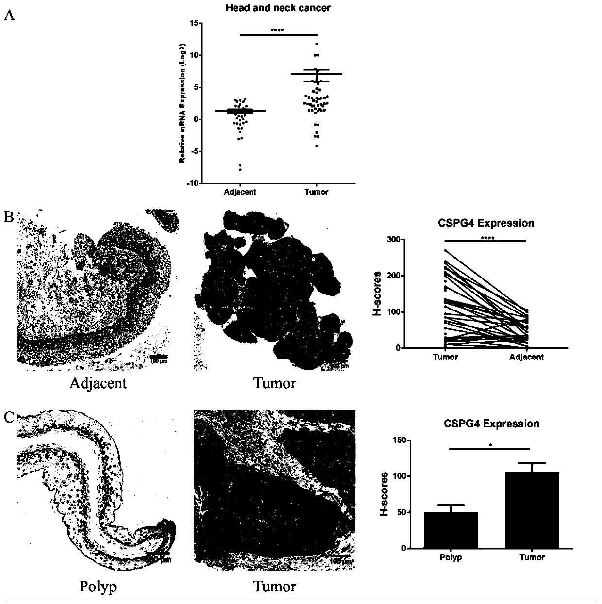 T lymphocyte of chimeric chondroitin sulfate proteoglycan 4 receptor as well as preparation method and application of T lymphocyte