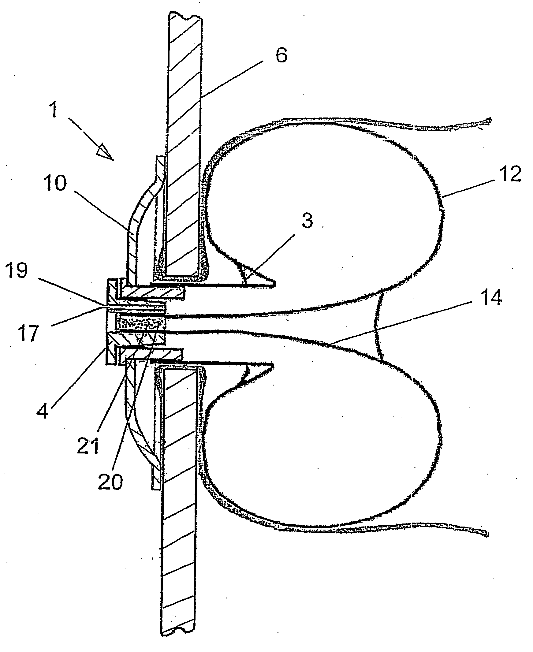 Closing system for a natural or artificial anus