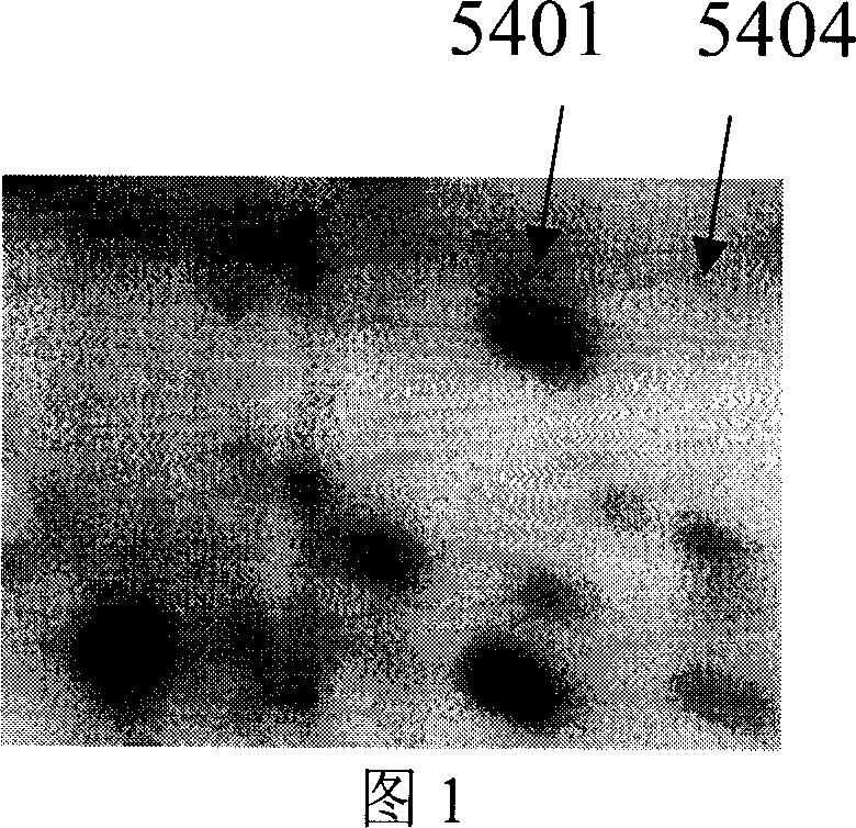 Aminoacylase 1 and application for examining liver cancer by antibody of same