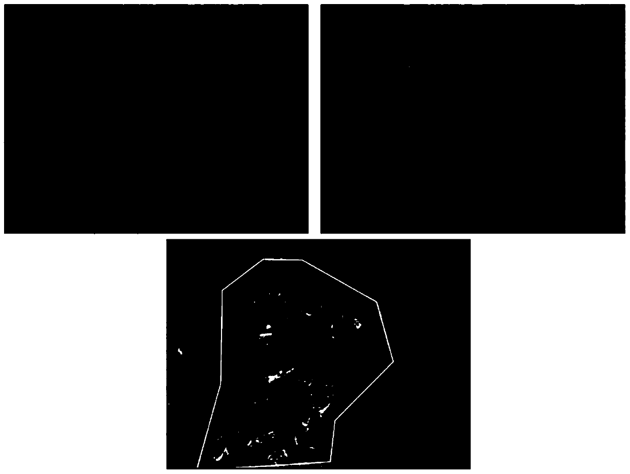 Method for predicting and enhancing efficacy of anti-PD-1 antibody or anti-PD-L1 antibody therapy, and method for evaluating cancer grade