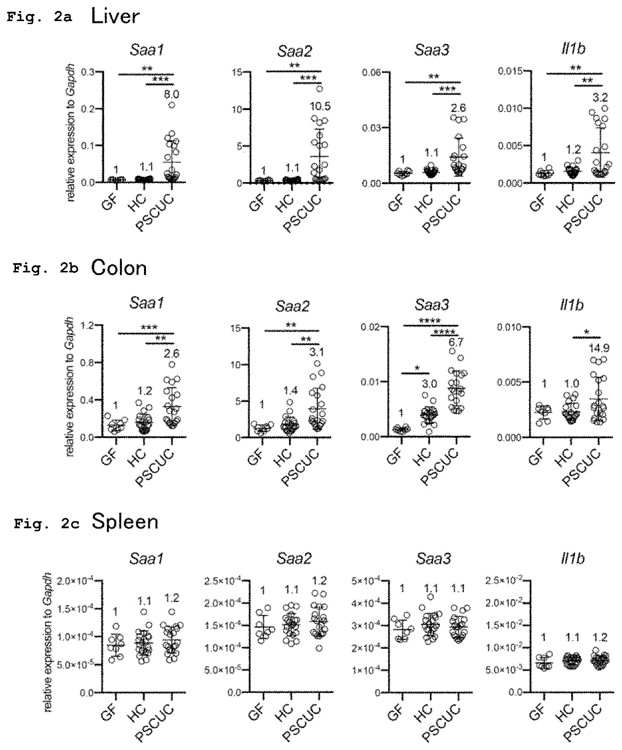 Klebsiella pneumoniae strain inducing inflammation in liver