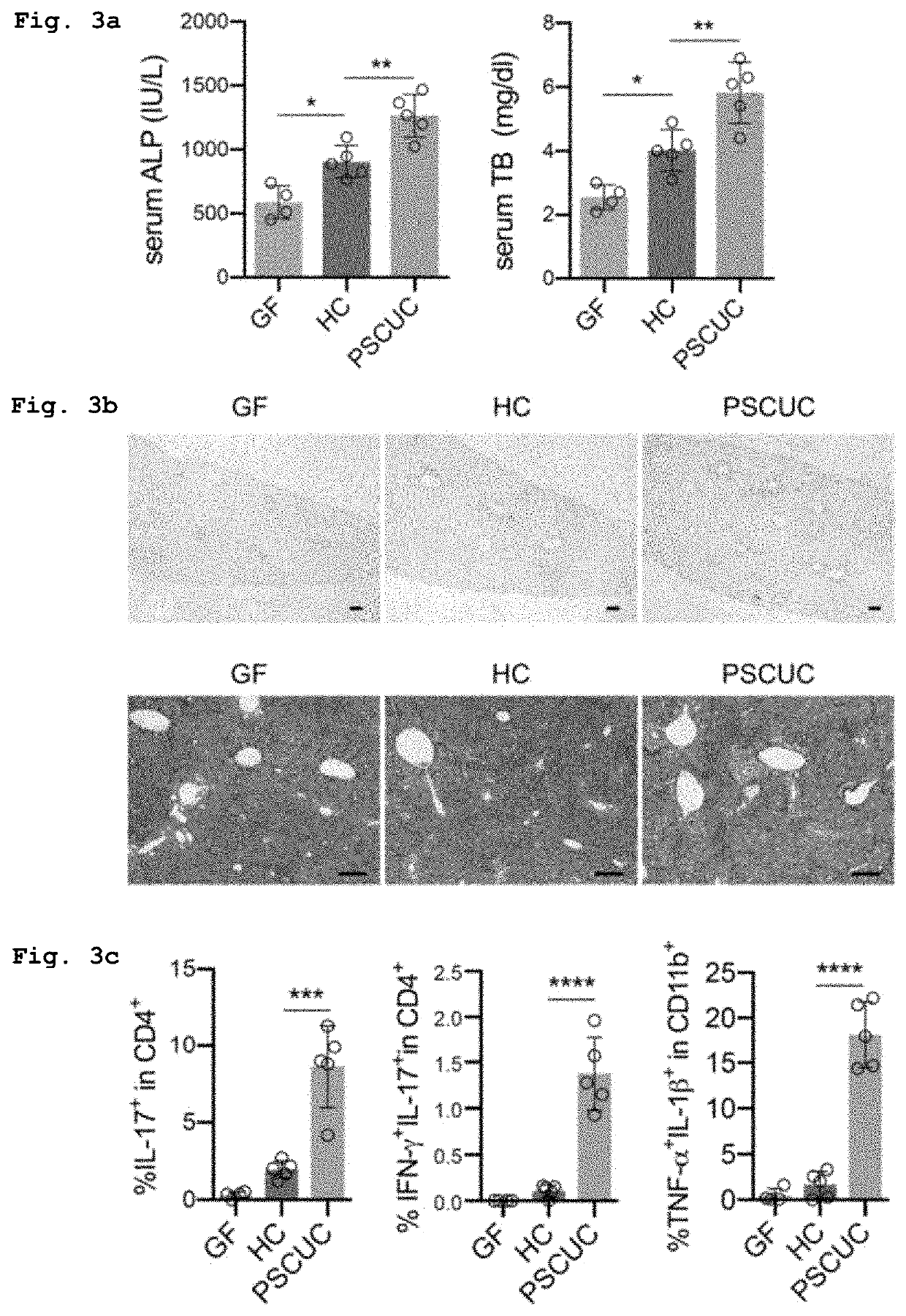 Klebsiella pneumoniae strain inducing inflammation in liver