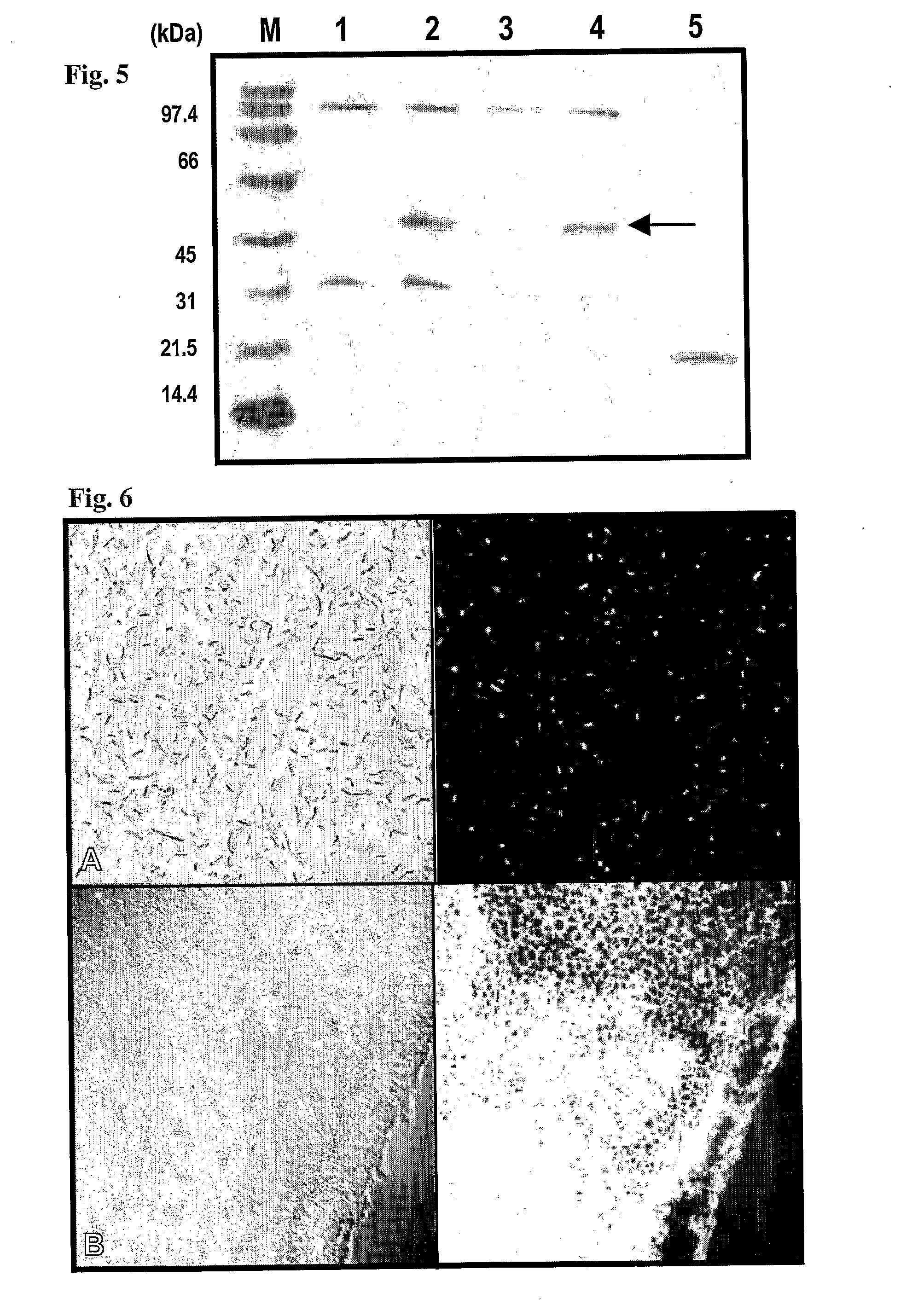 Recombinant lactobacillus and use of the same