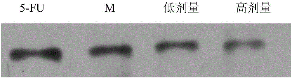 Traditional Chinese medicinal composition for preventing and treating malignant tumor of digestive tract and application of traditional Chinese medicinal composition