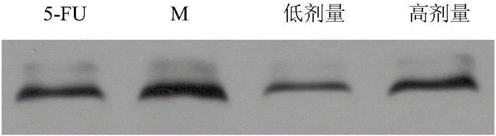 Traditional Chinese medicinal composition for preventing and treating malignant tumor of digestive tract and application of traditional Chinese medicinal composition