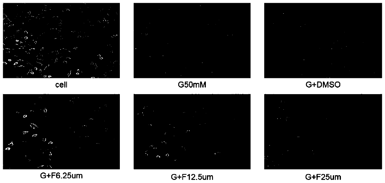 Application of syringaresinol in preparation of medicines for treating depression