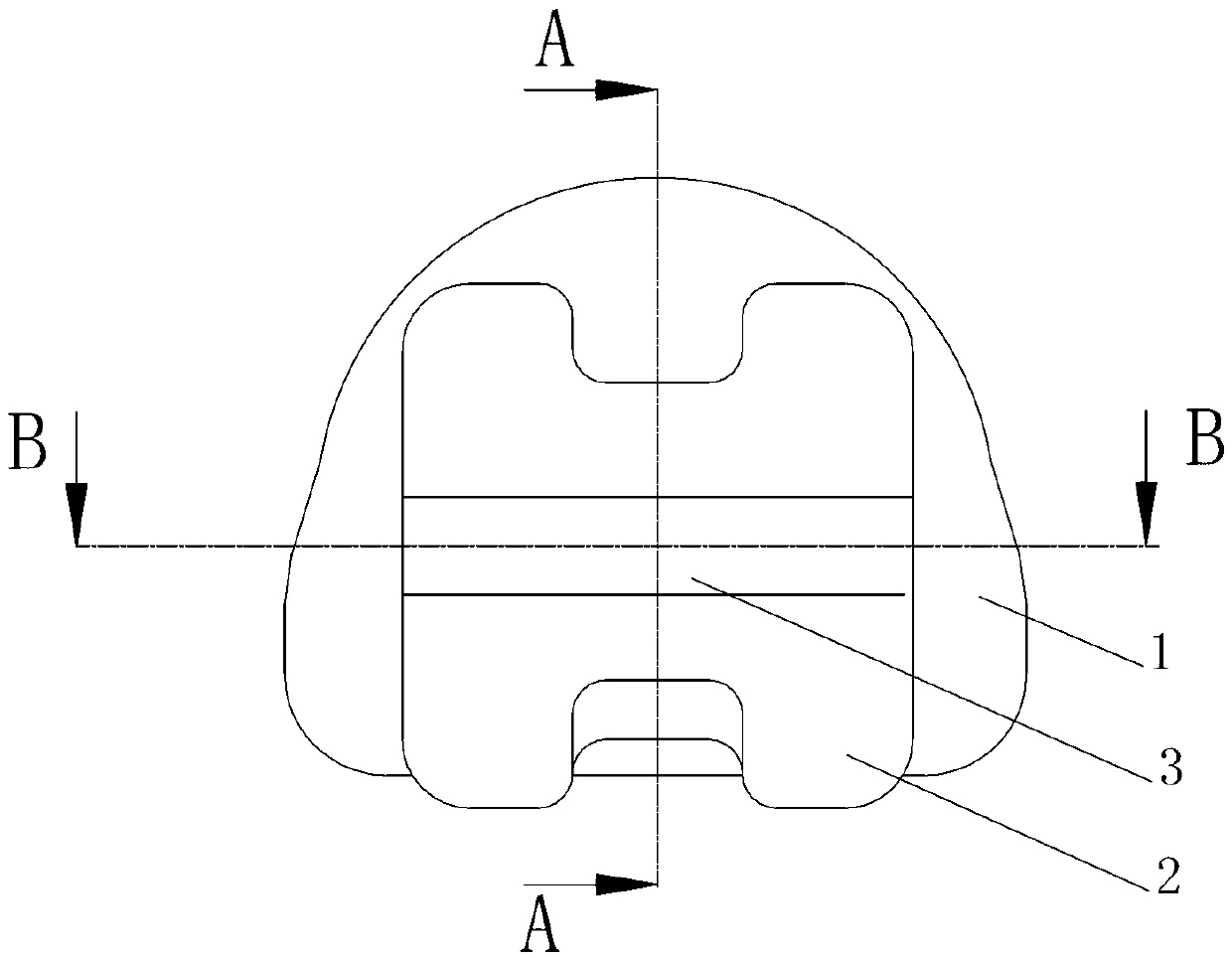 Self-locking orthodontic bracket for tooth orthodontics