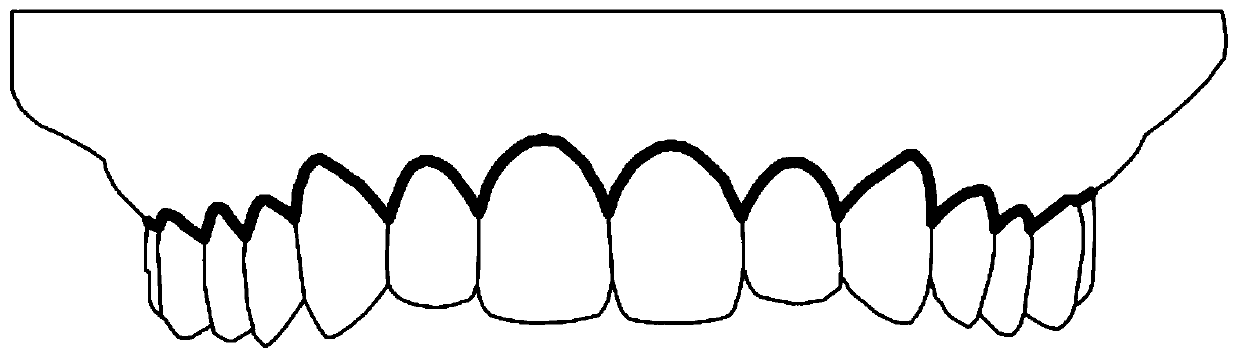 Method for guiding and segmenting teeth by utilizing morphological data