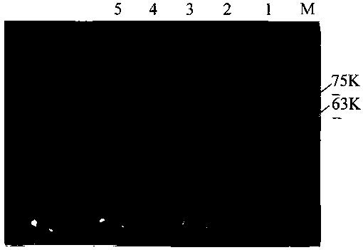 A terminal deoxyribonucleoside transferase variant and its application