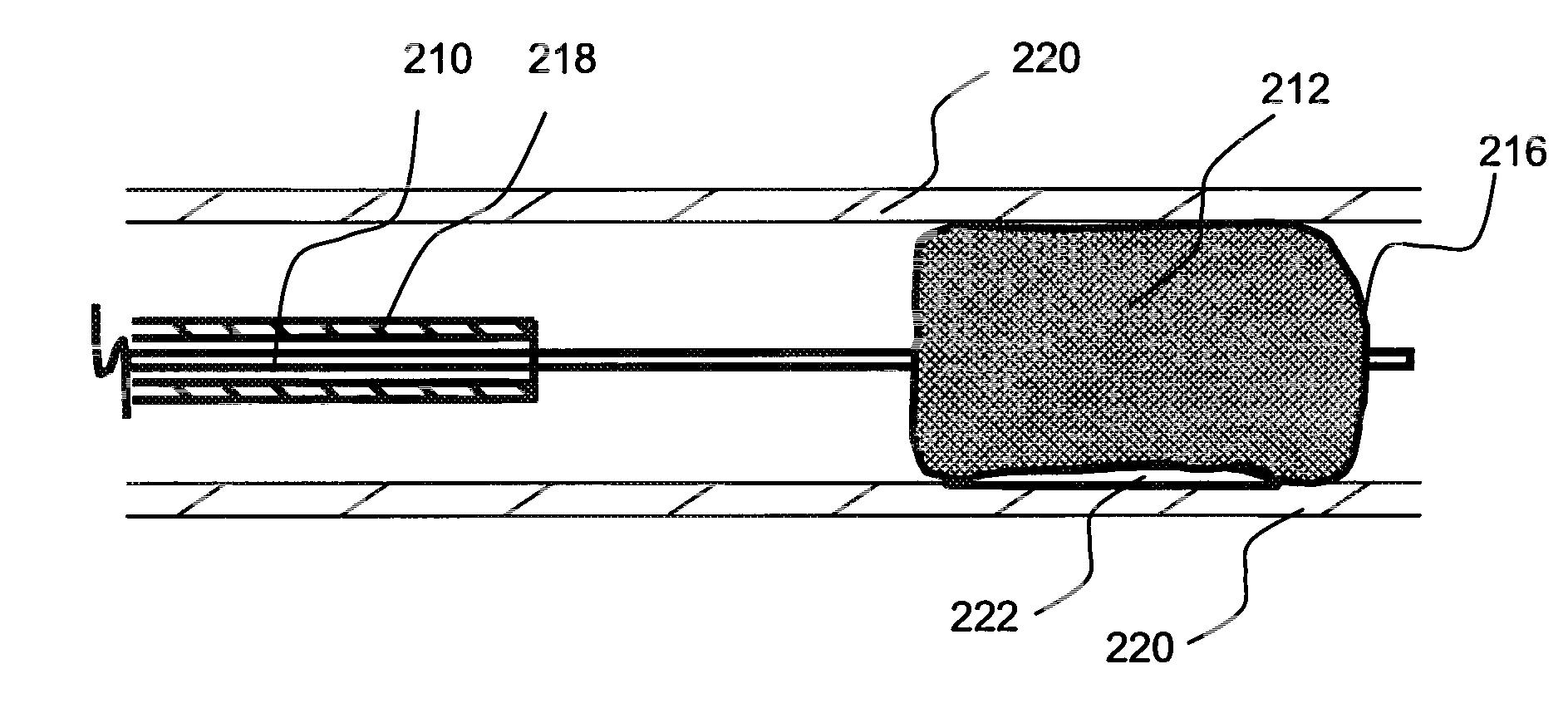 Local delivery of water-soluble or water-insoluble therapeutic agents to the surface of body lumens