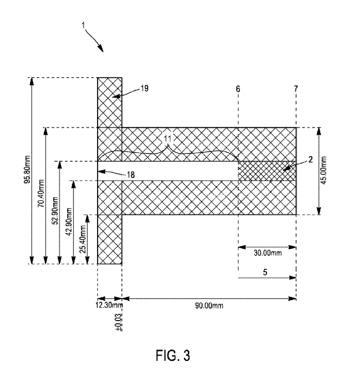 Minibeam radiotherapy device