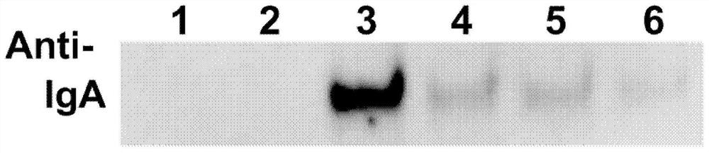 Method for diagnosing SARS-CoV-2 infection