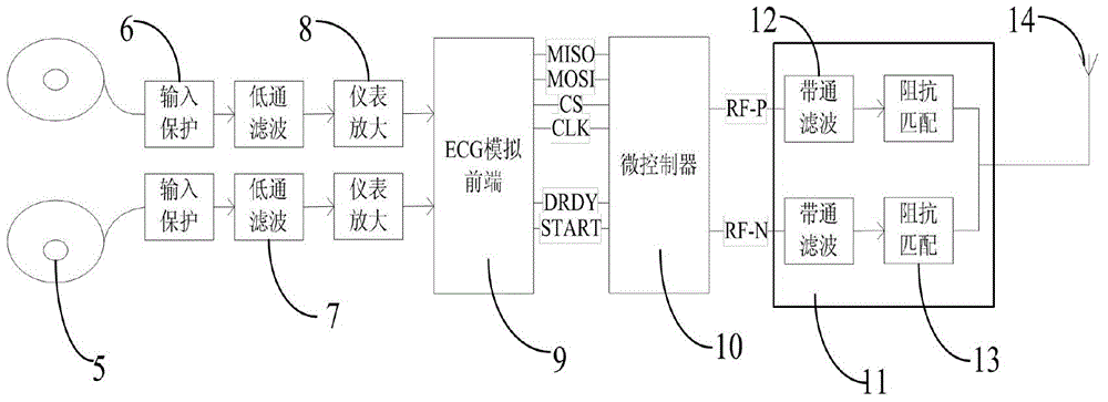 Tele electrocardiogram monitoring and diagnosing system