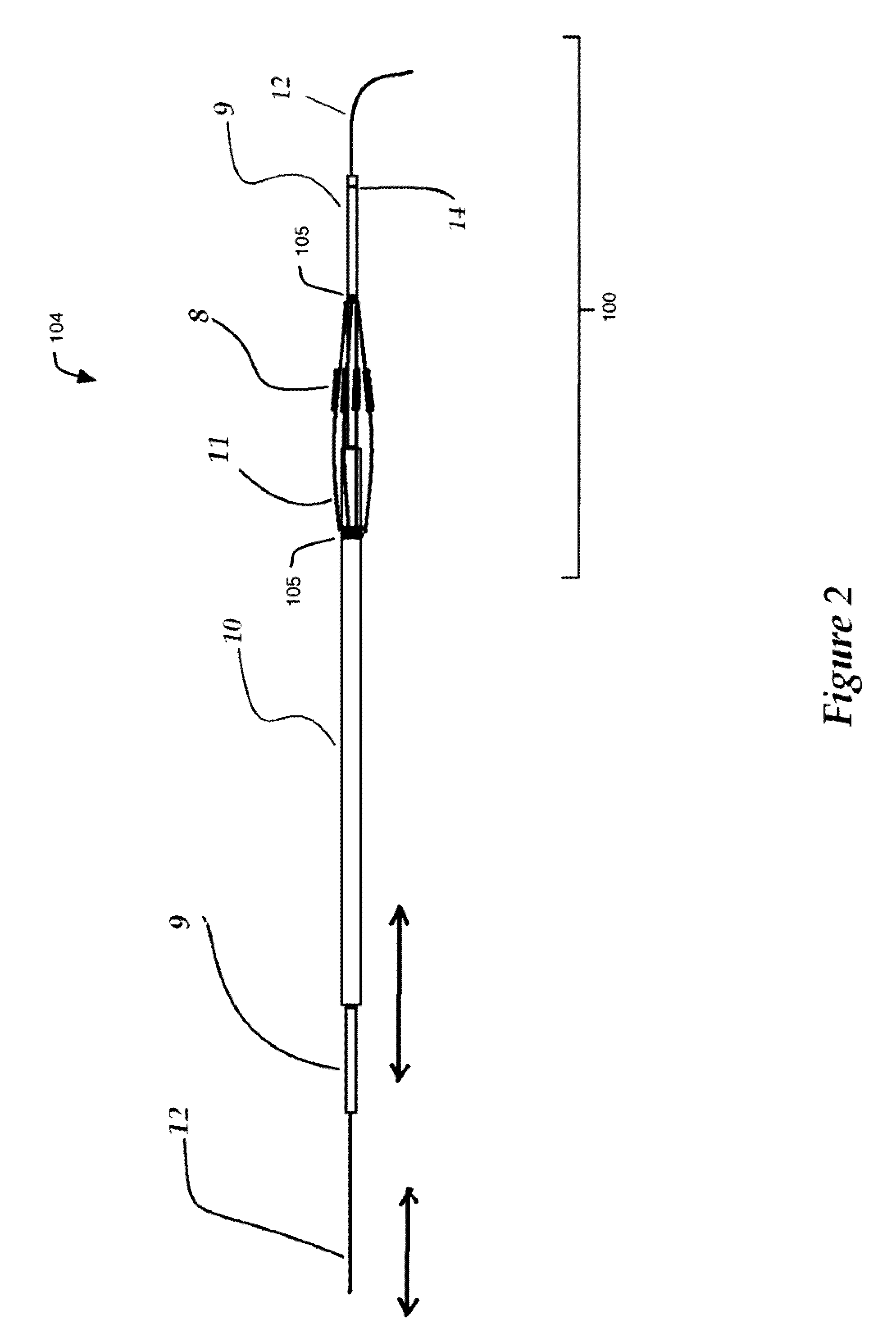 Device and method for treating annular organ structure