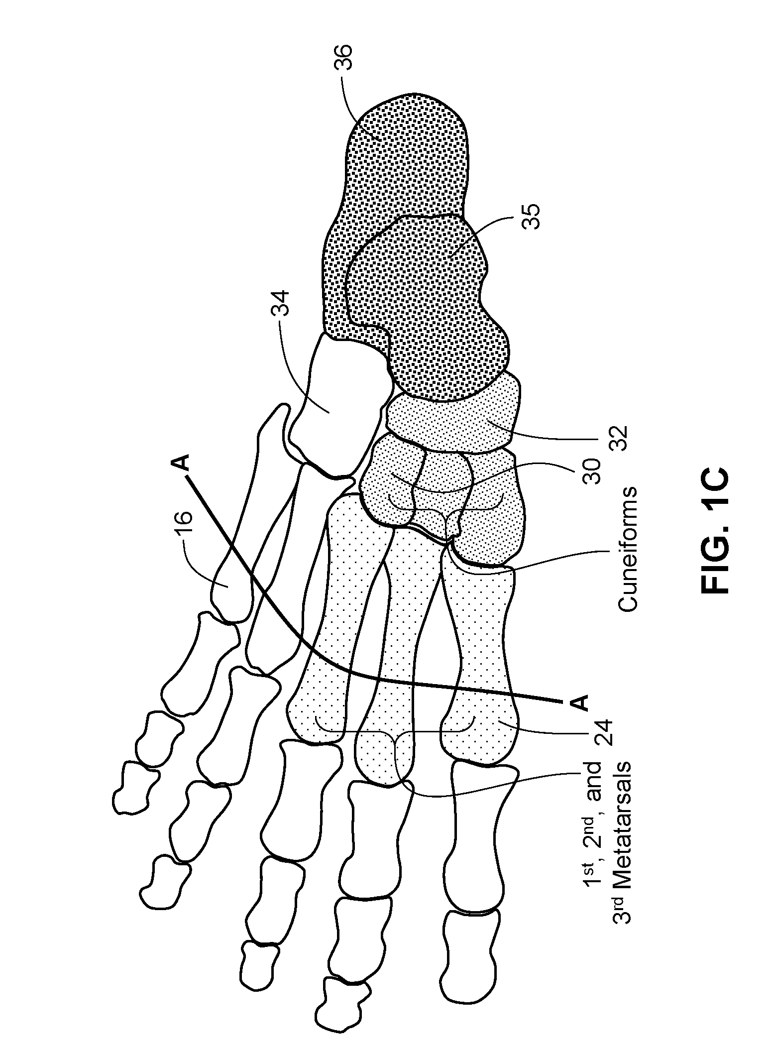 Methods and systems for sizing an orthotic device