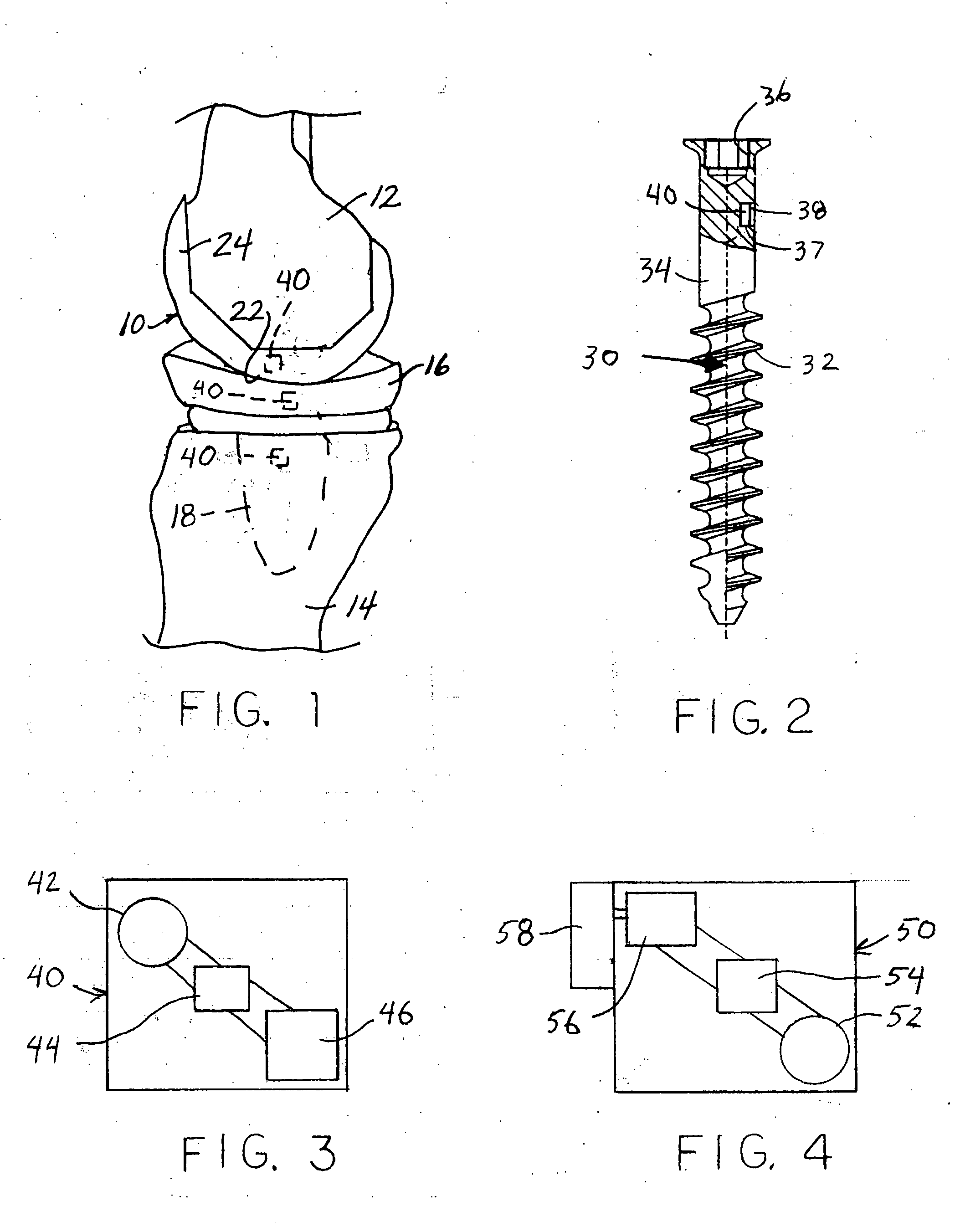 Orthopaedic components with data storage element