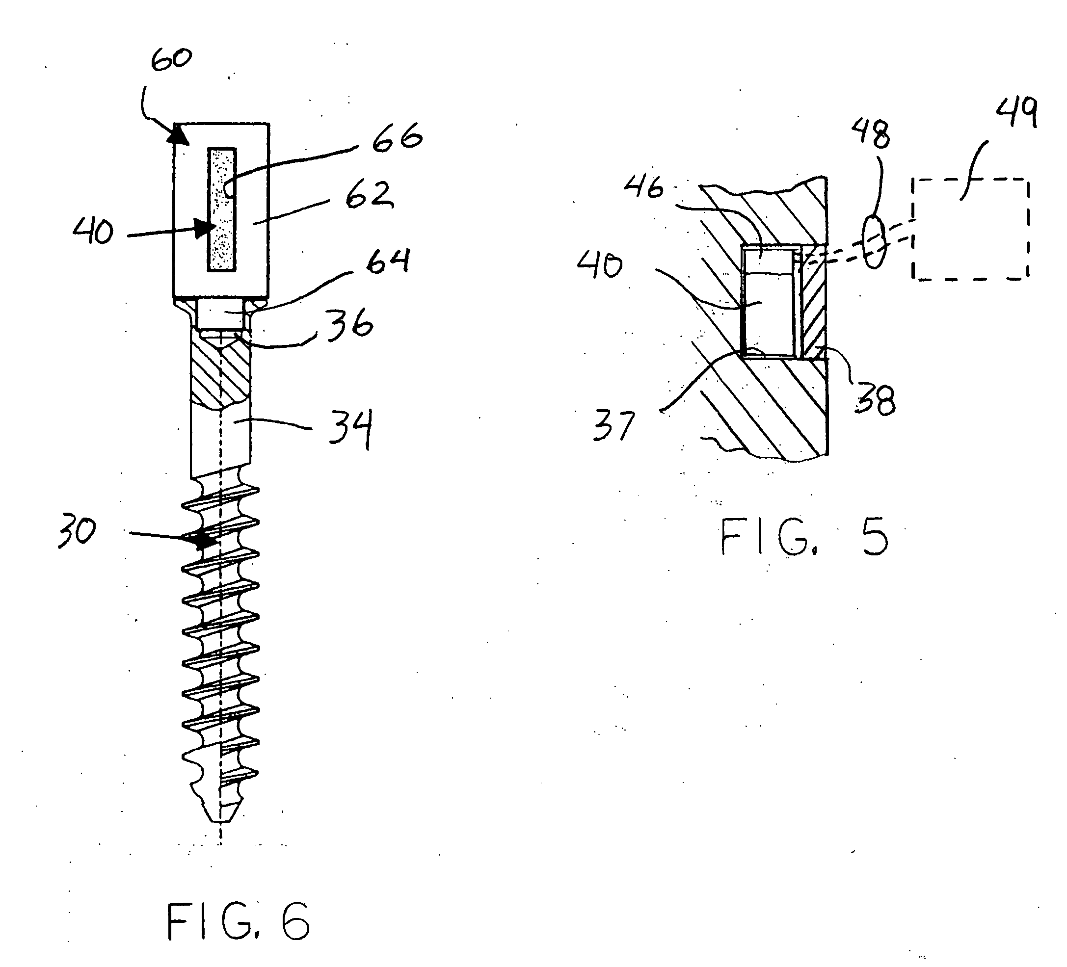 Orthopaedic components with data storage element