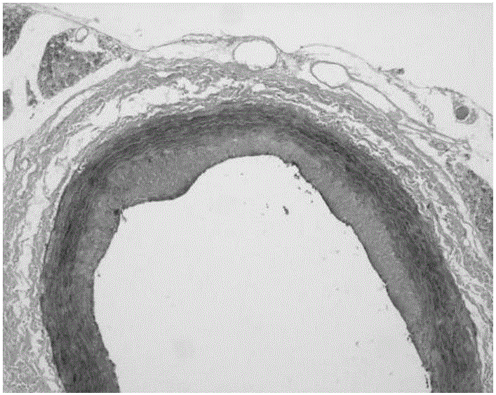 Application of radix astragali and radix angelica sinensis pharmaceutical composition in preventing vascular intimal hyperplasia