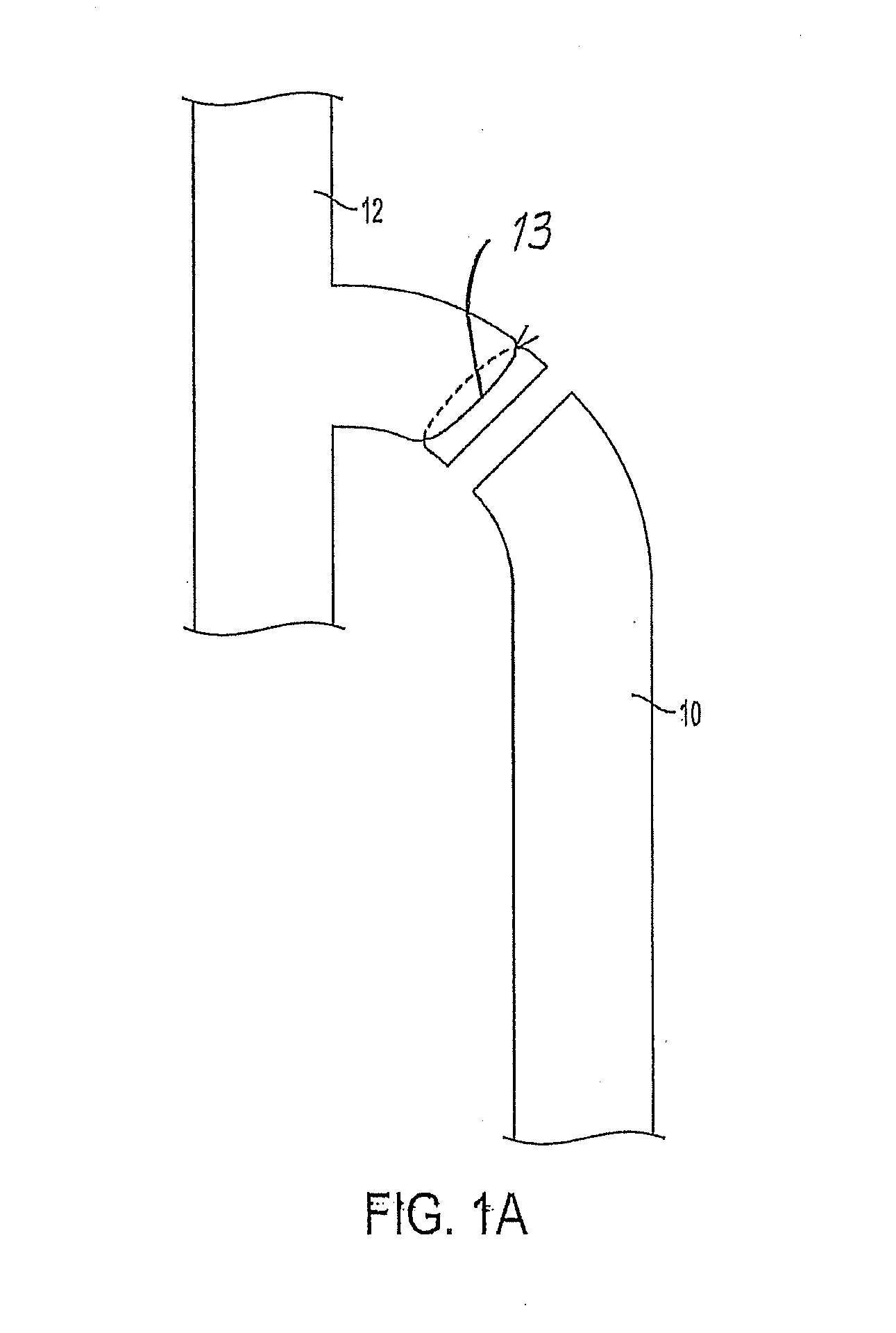 Venous closure catheter and method for sclerotherapy