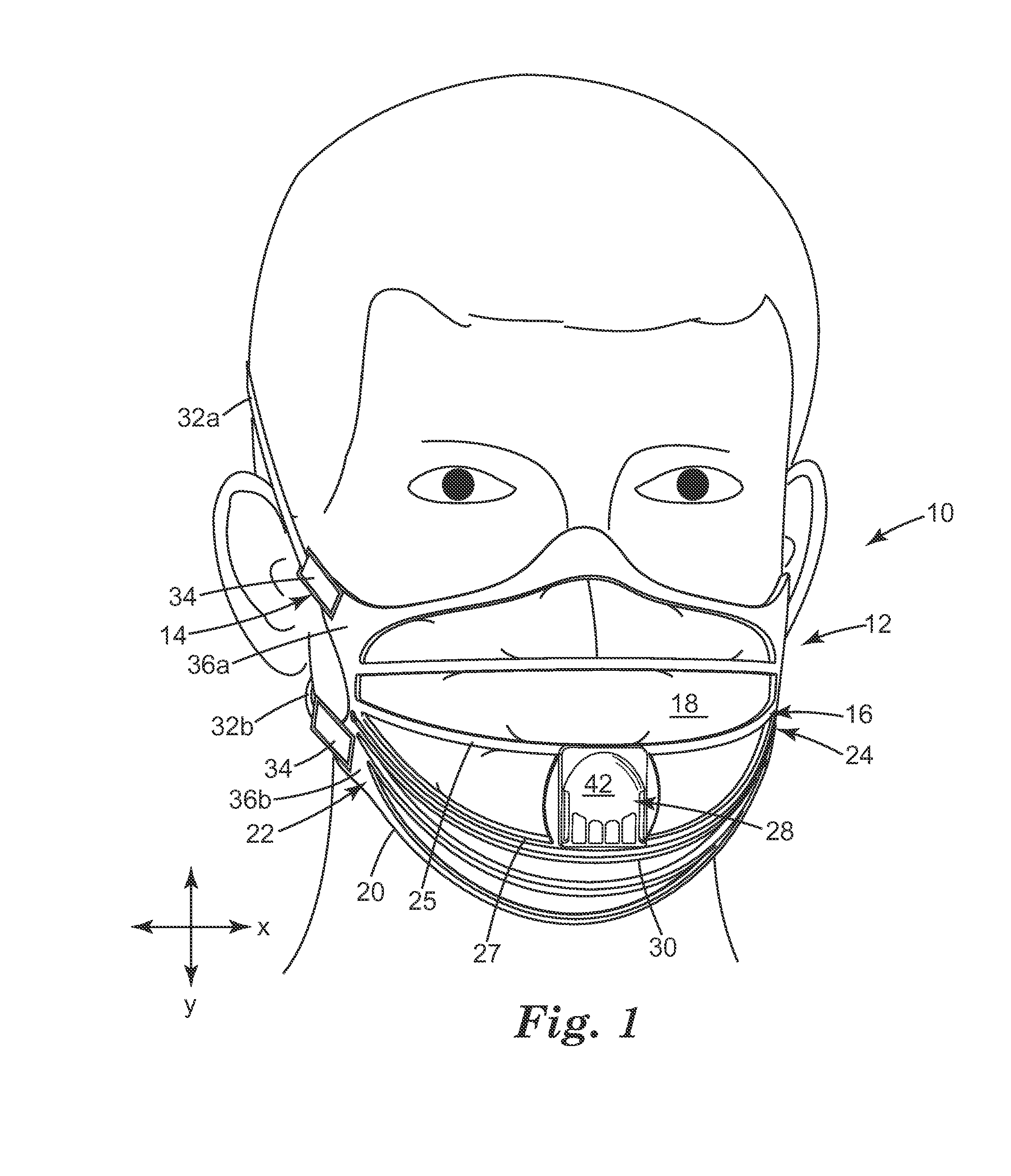 Filtering face-piece respirator having an integrally-joined exhalation valve