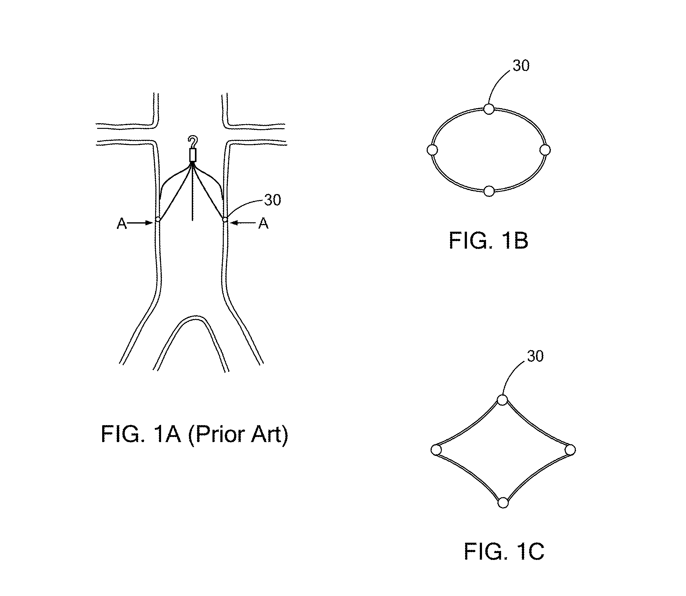 Low radial force filter