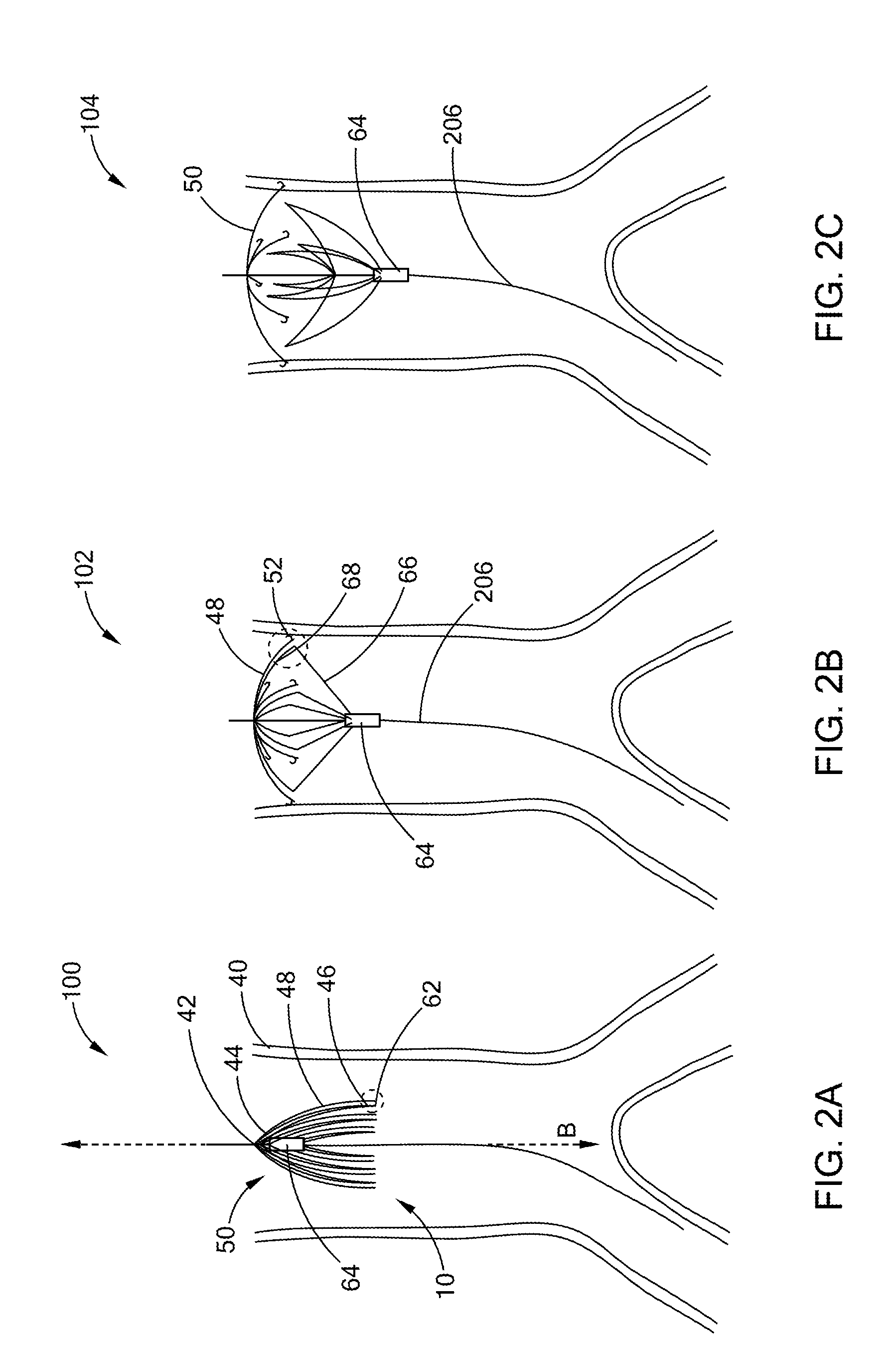 Low radial force filter