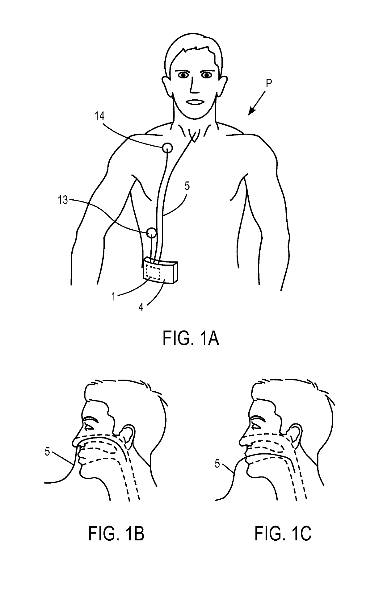 Ventilator with biofeedback monitoring and control for improving patient activity and health