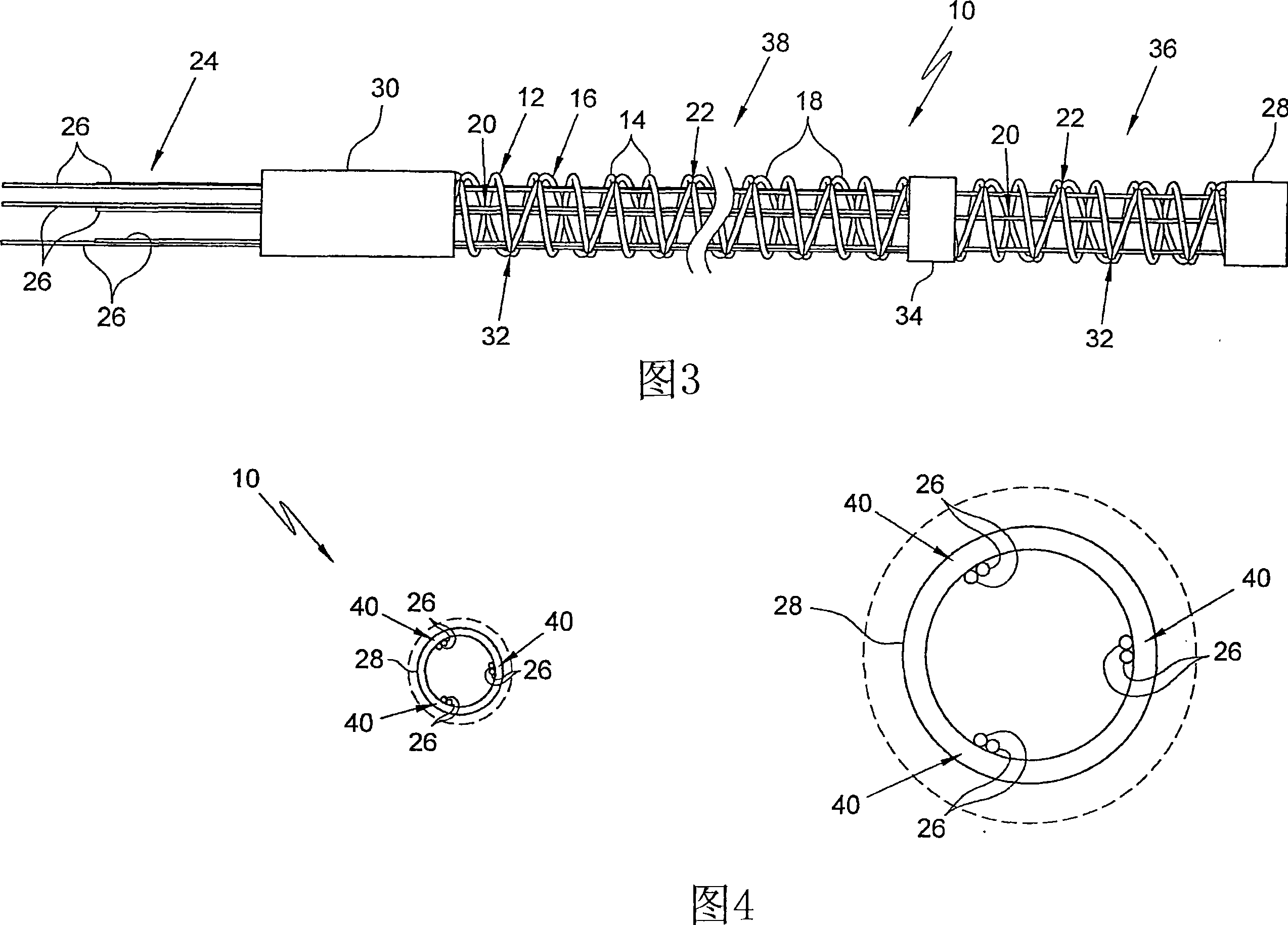 Sleeve steering and reinforcement