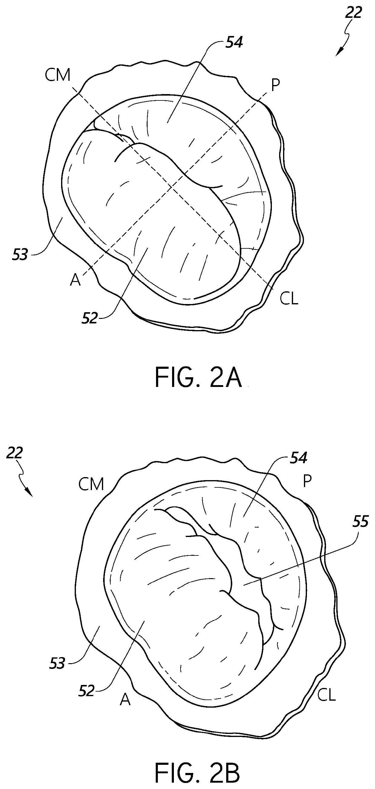 Implanting grafts to valve leaflets for cardiac procedures