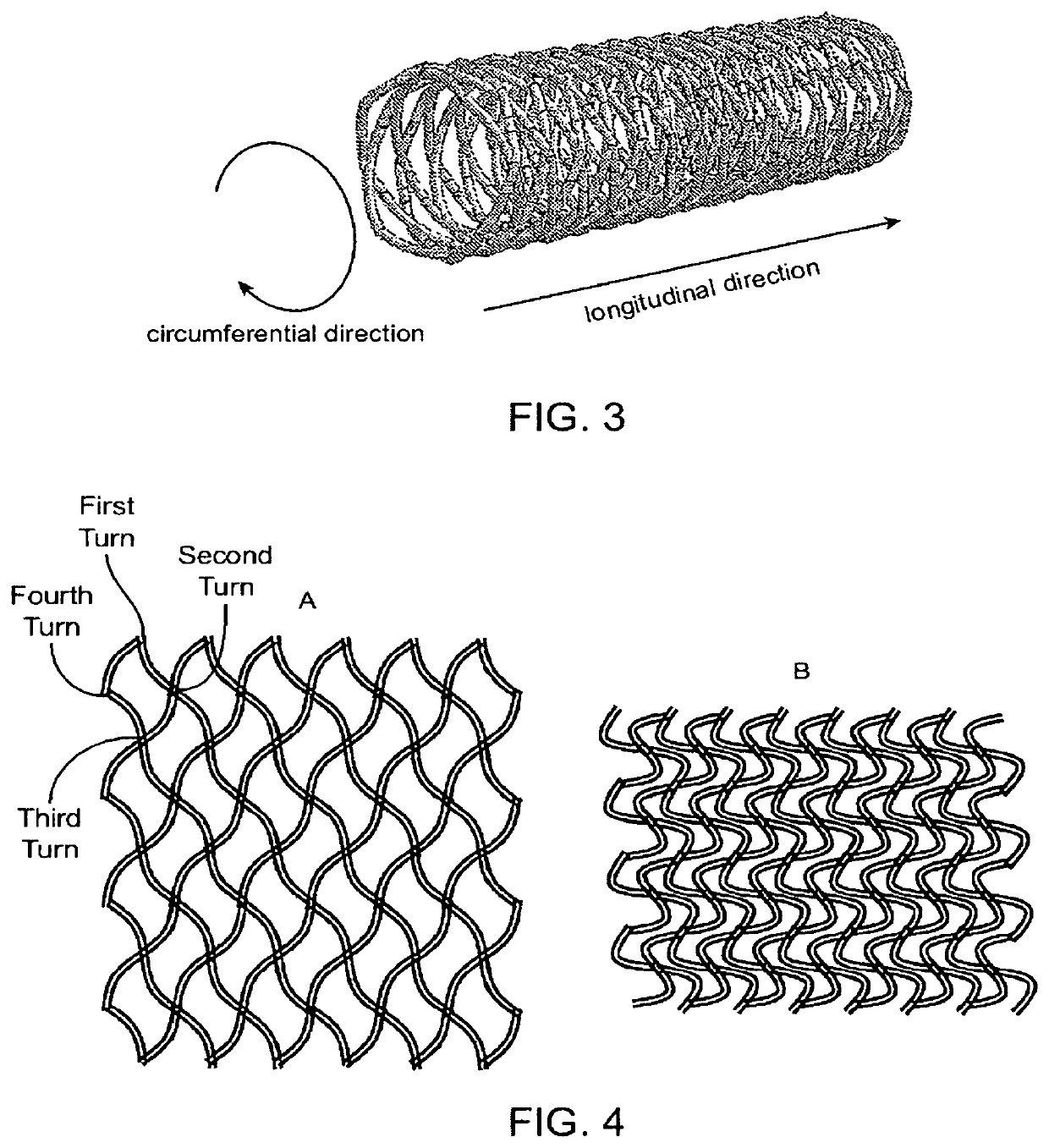 Close-cell structured stent, a preparation method and use thereof