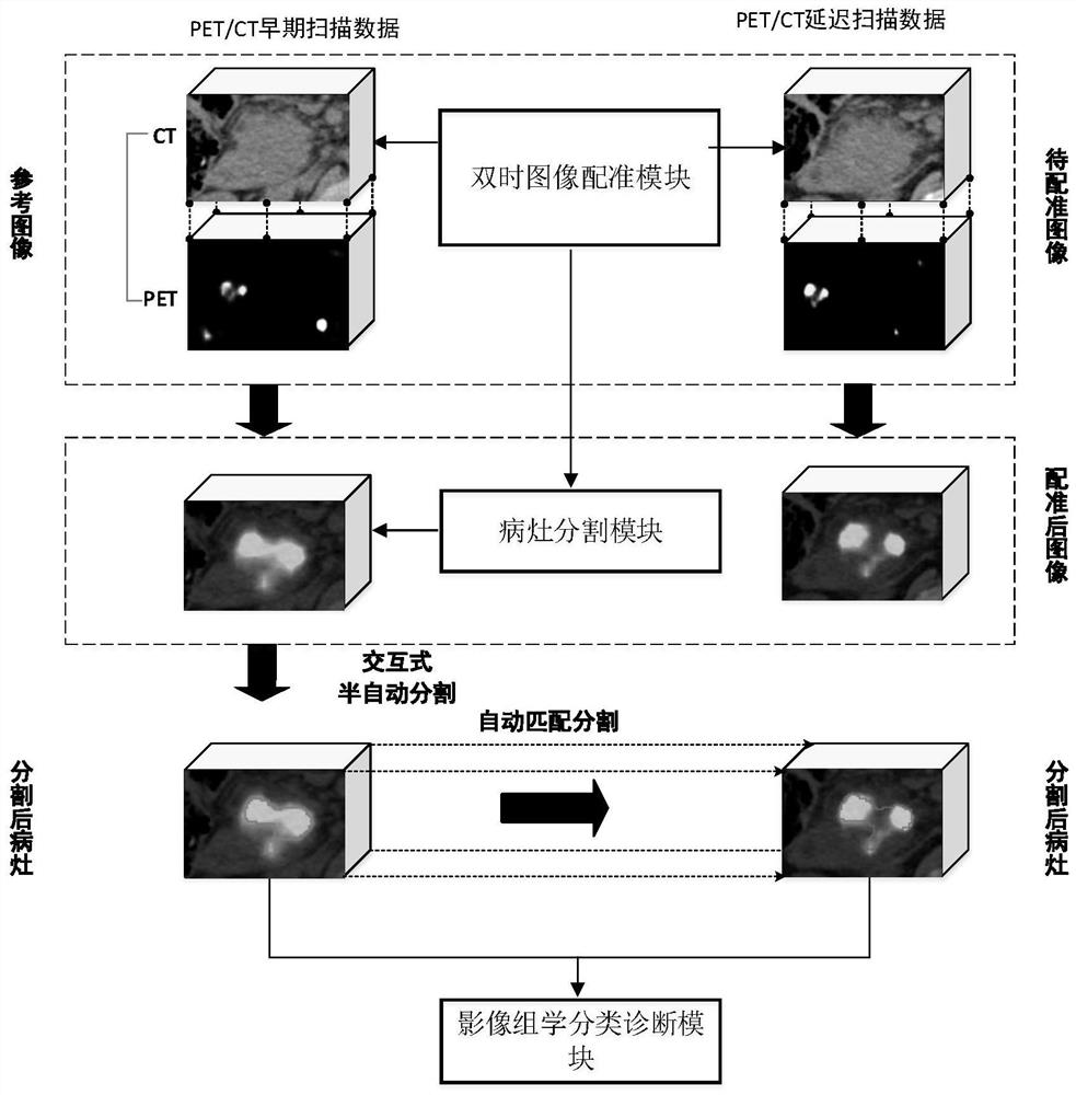 Pancreatic cancer accurate diagnosis system based on PET/CT double-time imaging