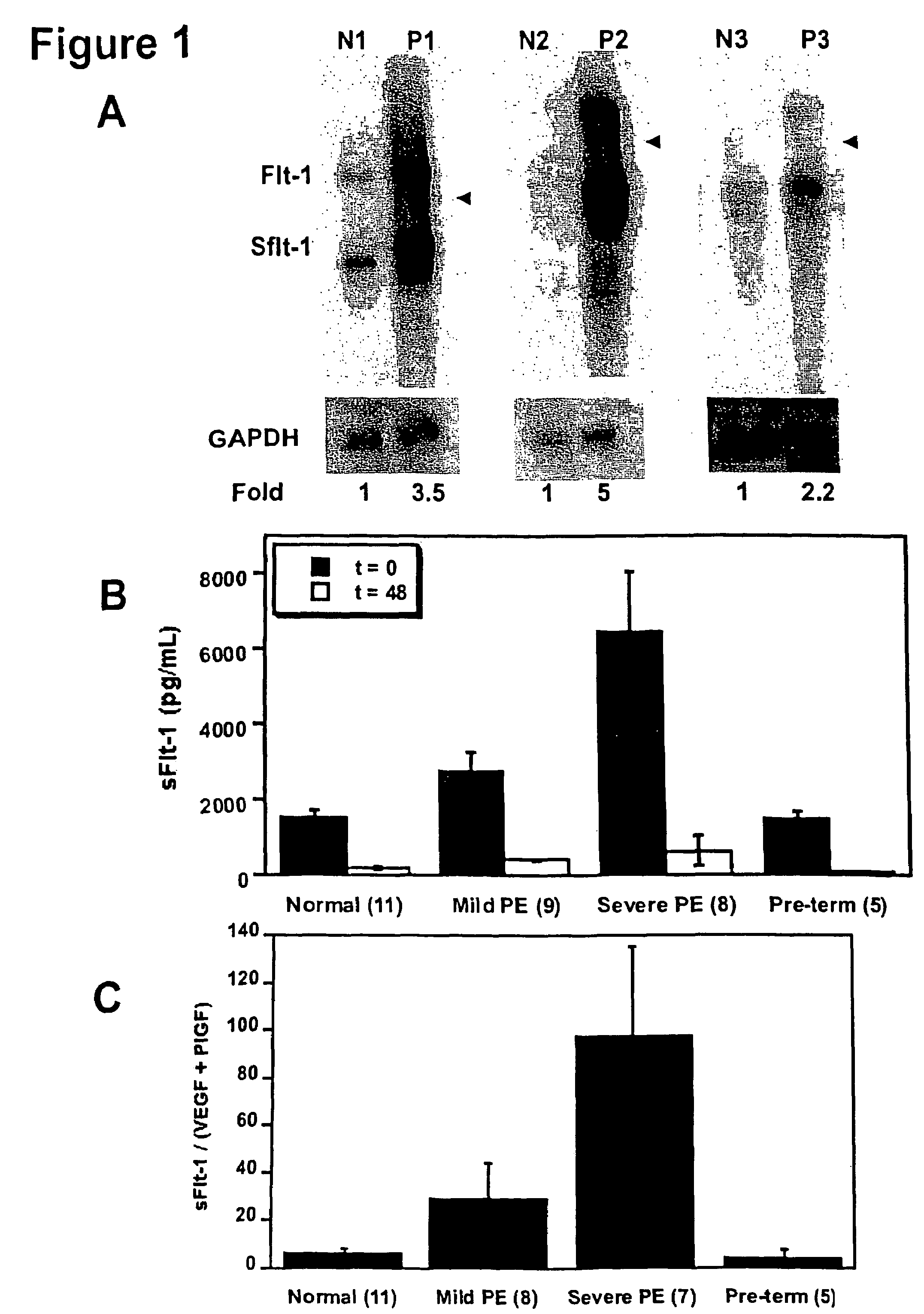 Methods of diagnosing and treating pre-eclampsia or eclampsia