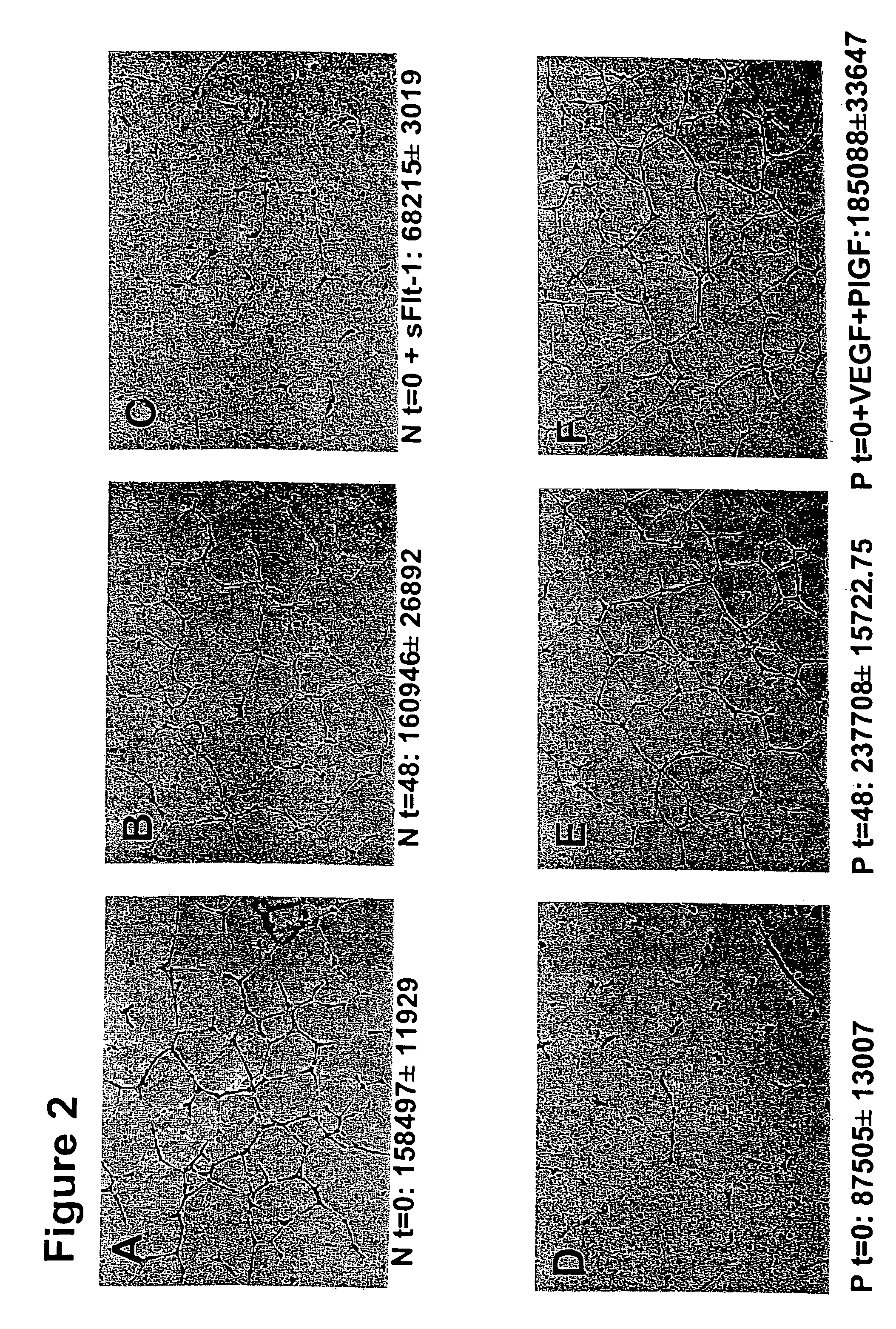 Methods of diagnosing and treating pre-eclampsia or eclampsia