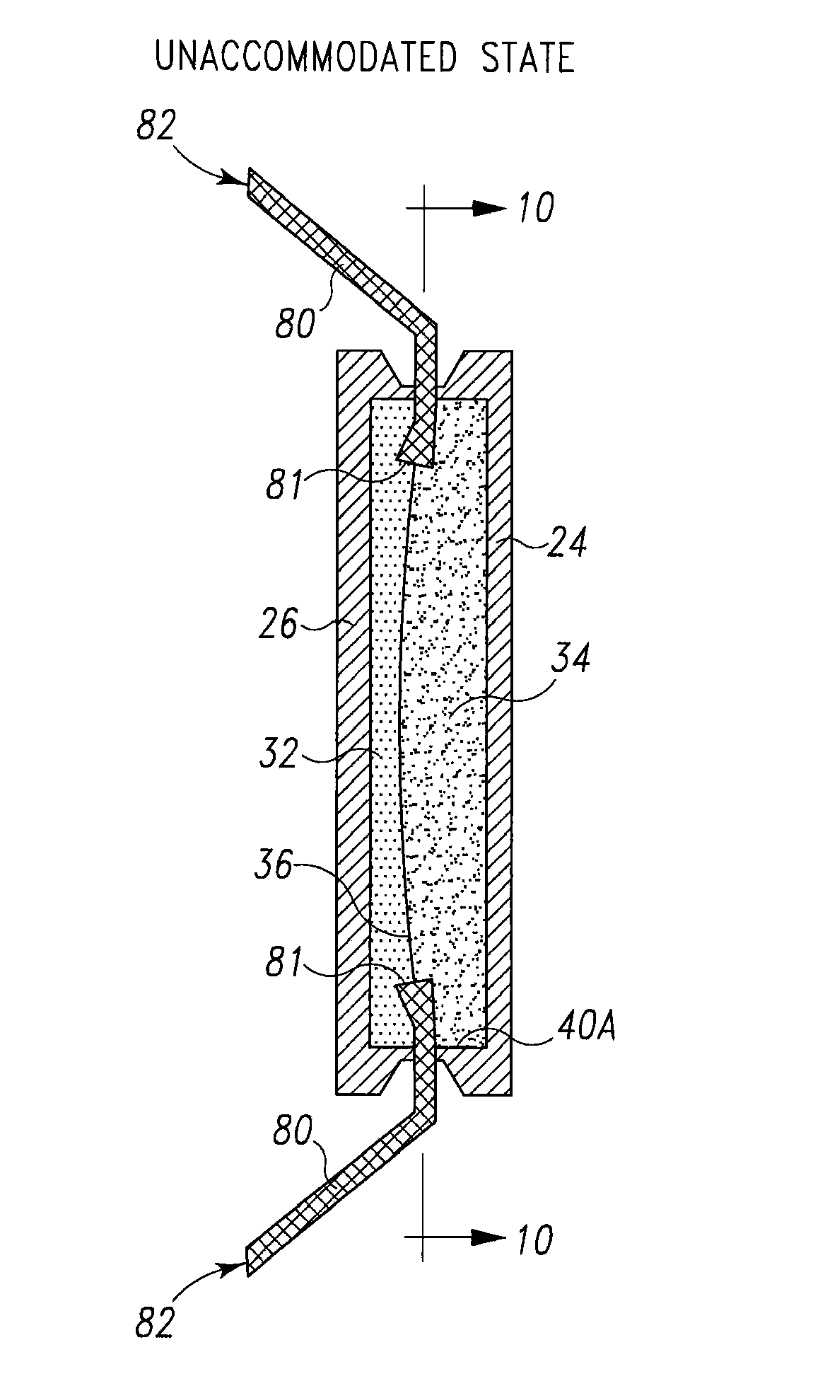 Interfacial refraction accommodating lens (IRAL)