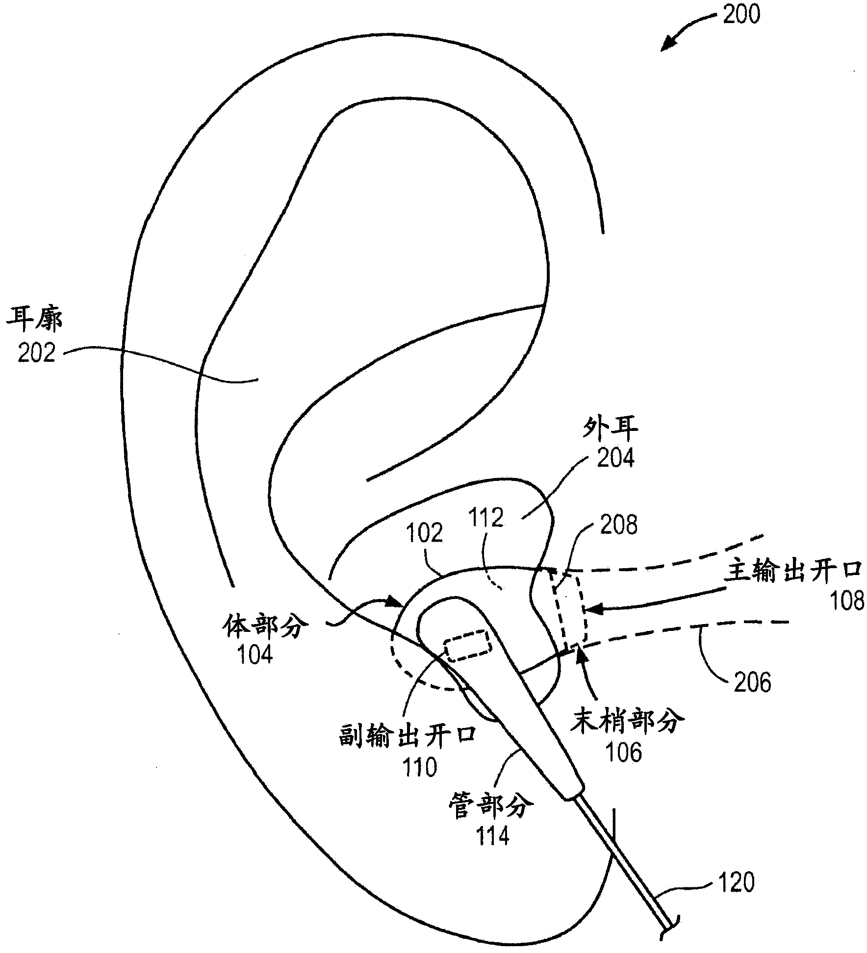 Earphone having acoustic tuning mechanism