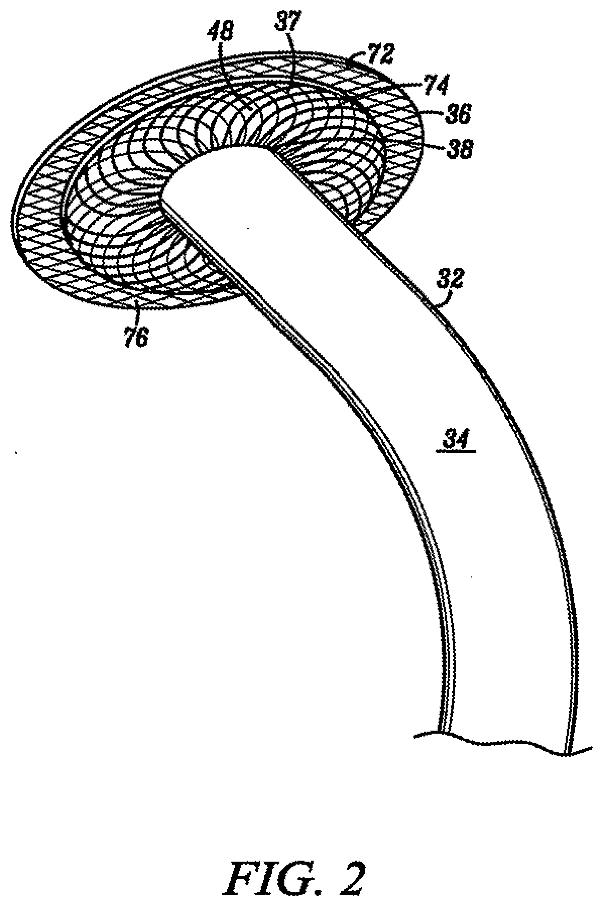 Percutaneous long term left ventricular assist device and non-invasive method for implanting same