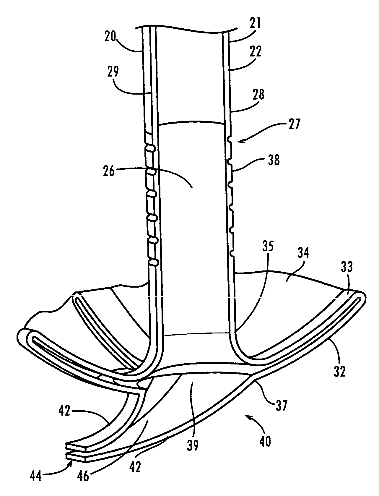 Ureteral stent