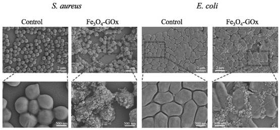 A cascade enzyme-like nanosystem for promoting diabetic wound healing and its preparation method and application