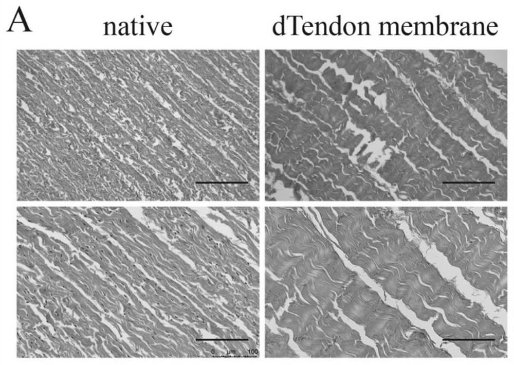 Poneurosis stent and preparation method and application thereof