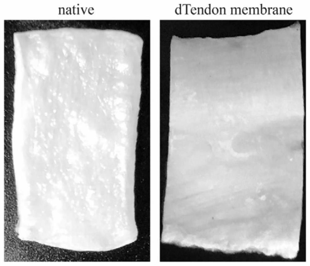 Poneurosis stent and preparation method and application thereof