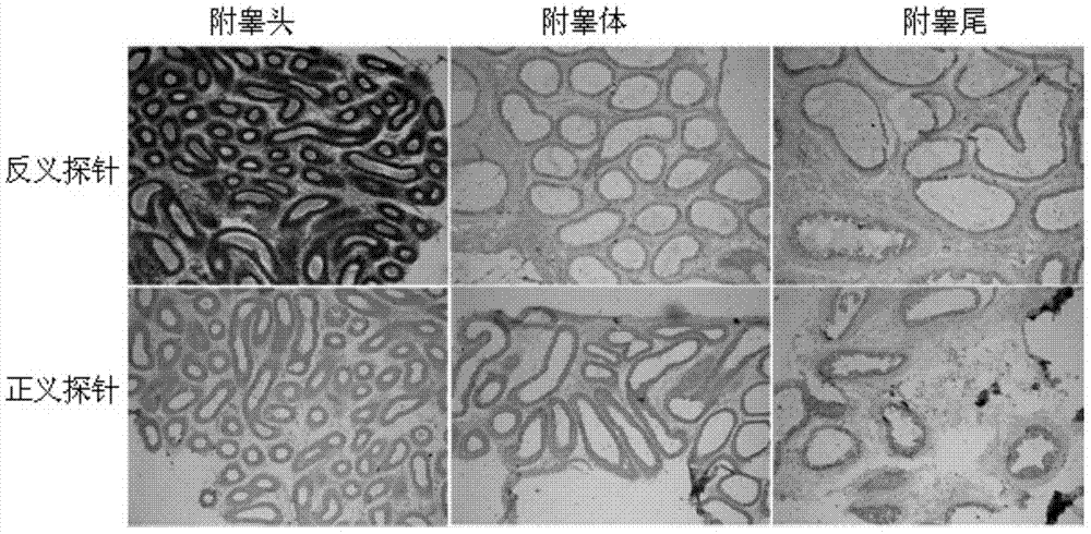 Interference fragment of colipase-like 2 (Clpsl2) gene and application of interference fragment