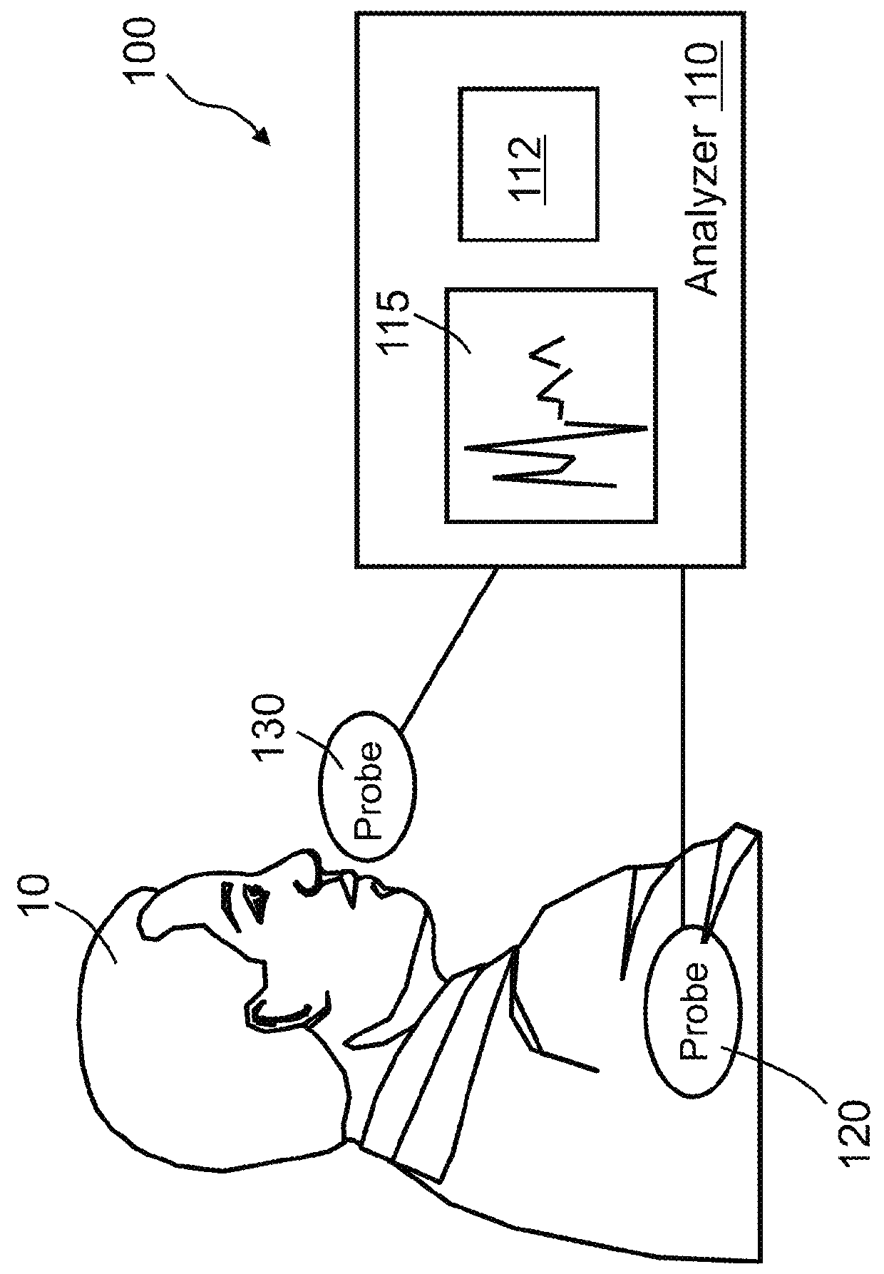 System and method for quantitative analysis of respiratory sinus arrhythmia